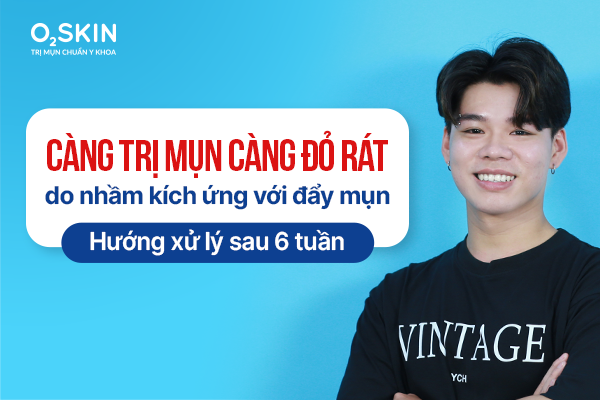 Làn da lão hóa sớm, xuất hiện nếp nhăn, nám da, tàn nhang do tác hại của tia UV